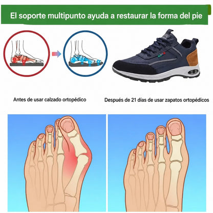 🎉 ¡Último día! ¡50% de descuento! ✅ Calzado ortopédico diseñado específicamente para personas con problemas en los pies; ofrece soporte para el arco y alivia el dolor de espalda, articulaciones y pies.