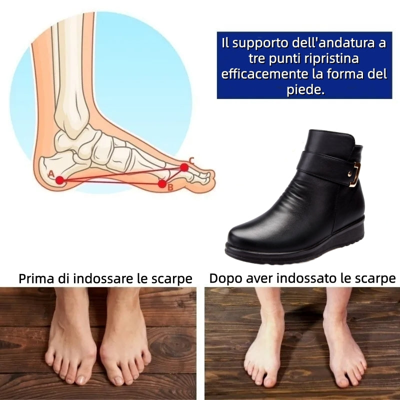 【⏰Ultimo giorno! Sconto del 70%! Non perdete l'occasione!】Scarpe ortopediche ergonomiche con assorbimento degli urti: calzature ortopediche invernali per la salute e il benessere, appositamente progettate per le donne europee✅️