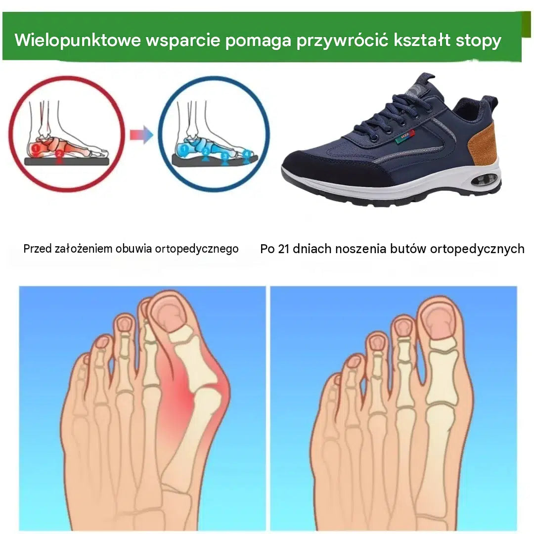 🎉Ostatni dzień! 60% zniżki! ✅ Buty ortopedyczne zaprojektowane specjalnie dla osób z problemami stóp, zapewniające wsparcie łuku stopy i łagodzące ból pleców, stawów i stóp.